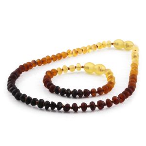 BALTIC AMBER SET FOR KIDS. ROUNDEL. XR53R1M